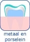 Materiaal kroon hongarije